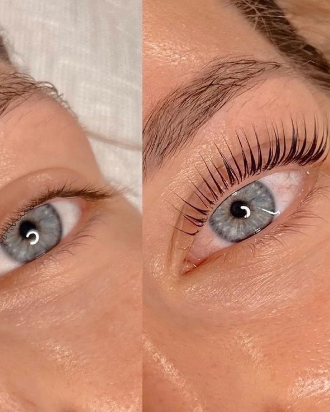 Apparative Anti-Aging Gesichtsbehandlungen bei Boudoir Cosmetics